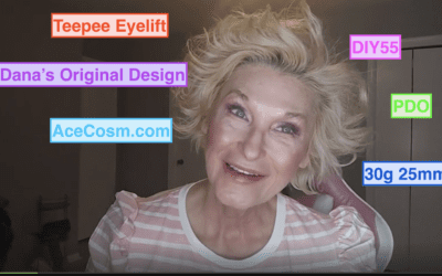 Teepee Eye Lift with PDO Threads